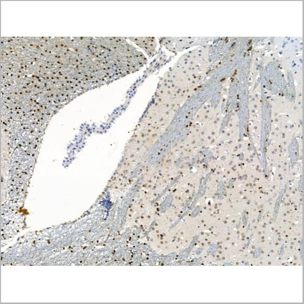 product-image-AAA31234_IHC5.jpg