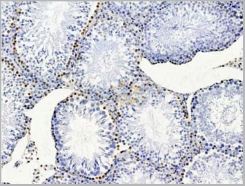 product-image-AAA31235_IHC3.jpg