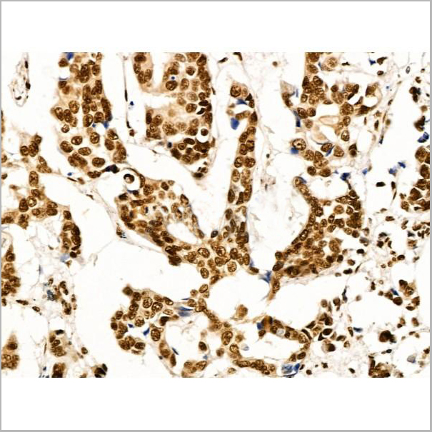 product-image-AAA31236_IHC2.jpg