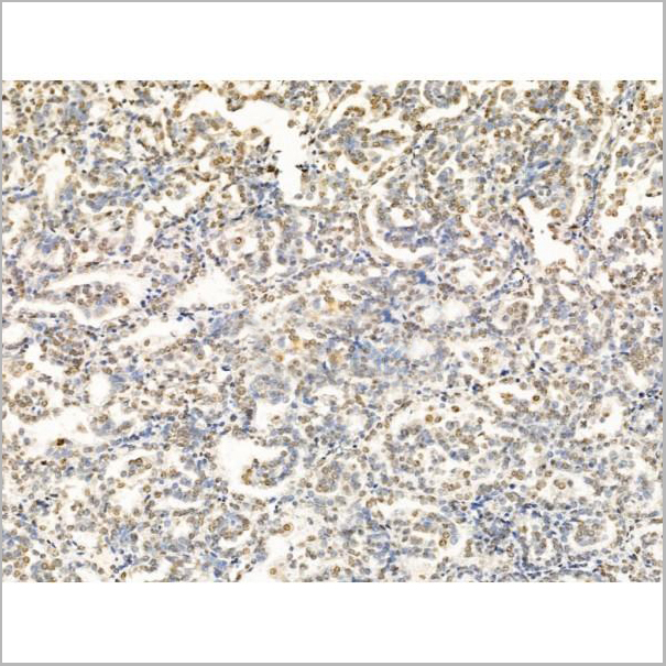 product-image-AAA31236_IHC5.jpg