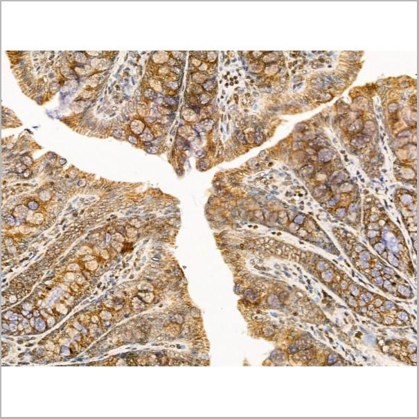 product-image-AAA31237_IHC2.jpg