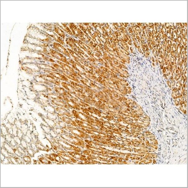 product-image-AAA31237_IHC3.jpg