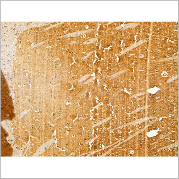 product-image-AAA31237_IHC4.jpg