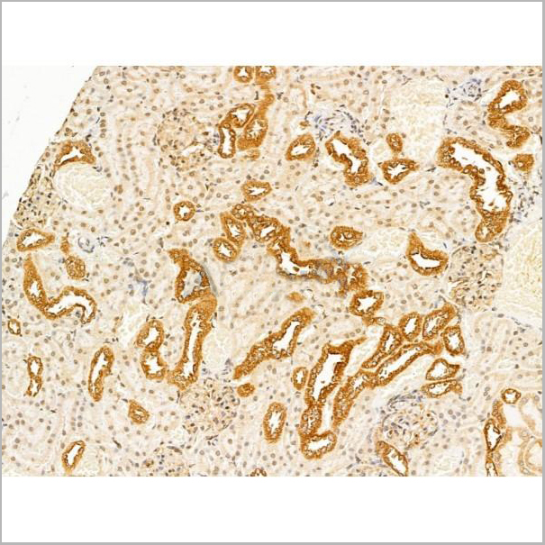 product-image-AAA31237_IHC5.jpg