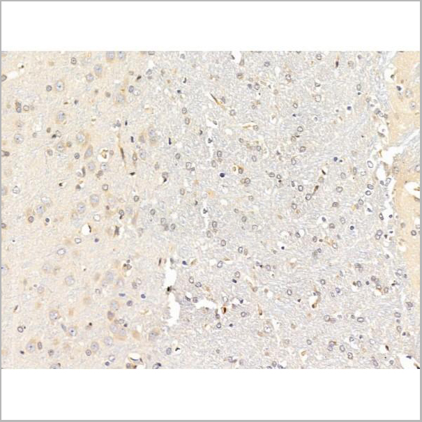 product-image-AAA31238_IHC3.jpg