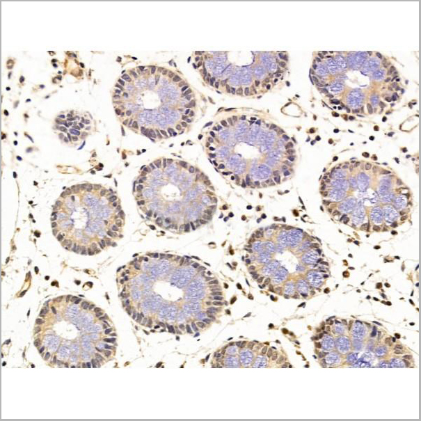 product-image-AAA31238_IHC6.jpg