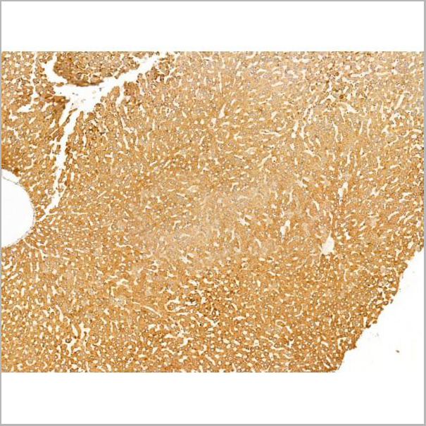 product-image-AAA31239_IHC2.jpg