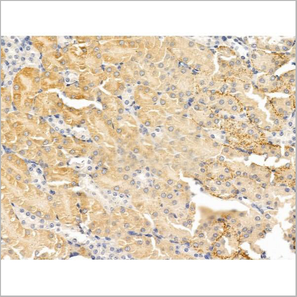 product-image-AAA31239_IHC5.jpg