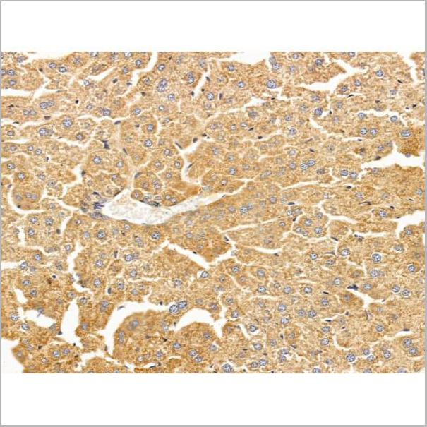 product-image-AAA31239_IHC6.jpg