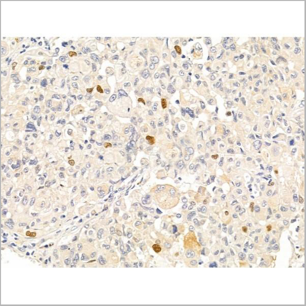 product-image-AAA31240_IHC2.jpg