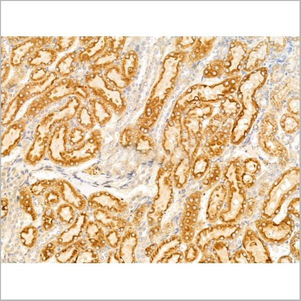 product-image-AAA31241_IHC2.jpg