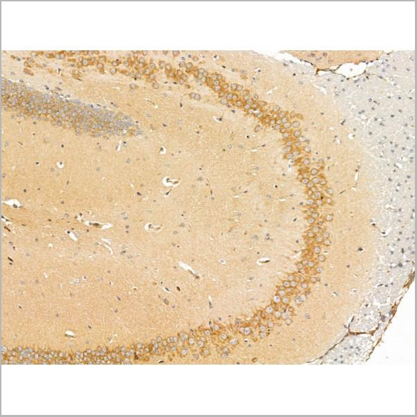 product-image-AAA31241_IHC5.jpg