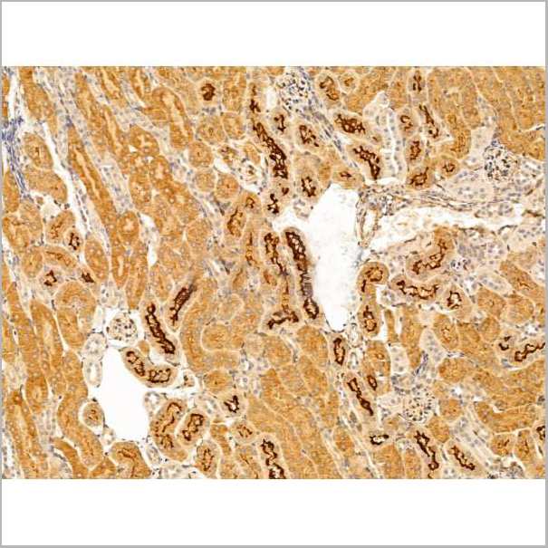 product-image-AAA31241_IHC6.jpg