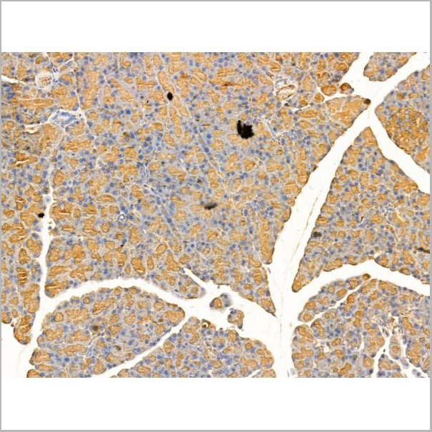 product-image-AAA31242_IHC2.jpg