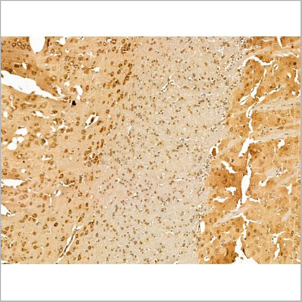 product-image-AAA31242_IHC3.jpg