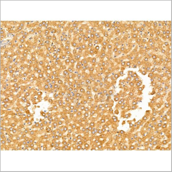product-image-AAA31242_IHC4.jpg