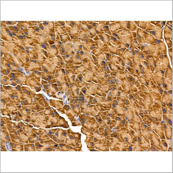 product-image-AAA31242_IHC5.jpg
