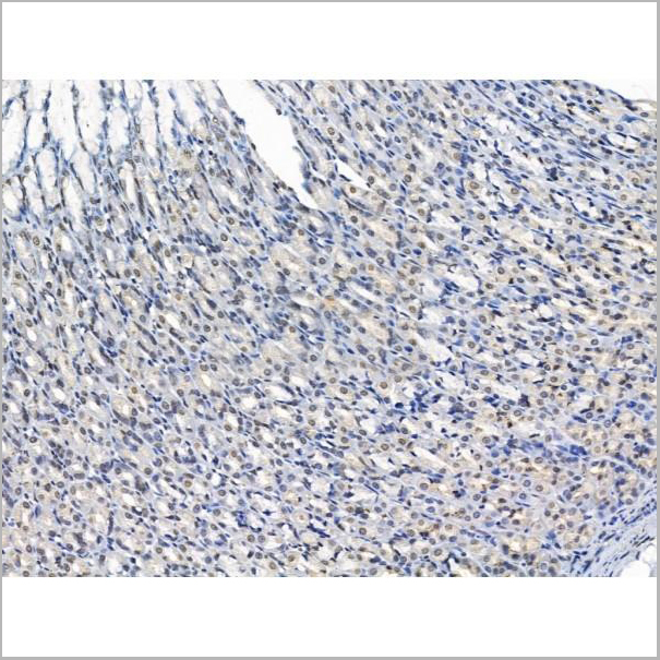 product-image-AAA31243_IHC3.jpg