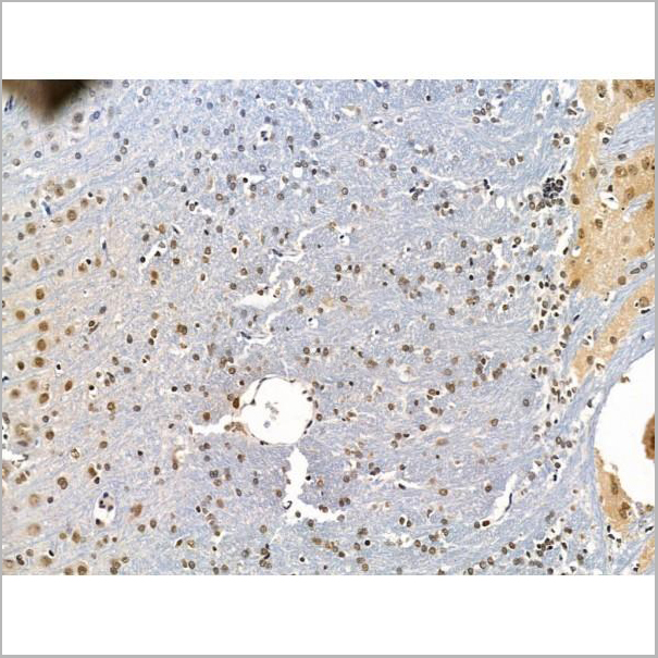 product-image-AAA31243_IHC4.jpg