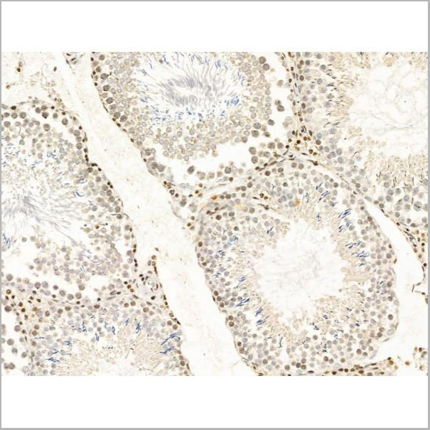 product-image-AAA31244_IHC2.jpg