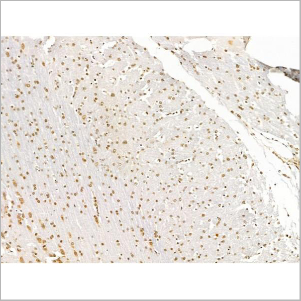 product-image-AAA31244_IHC3.jpg