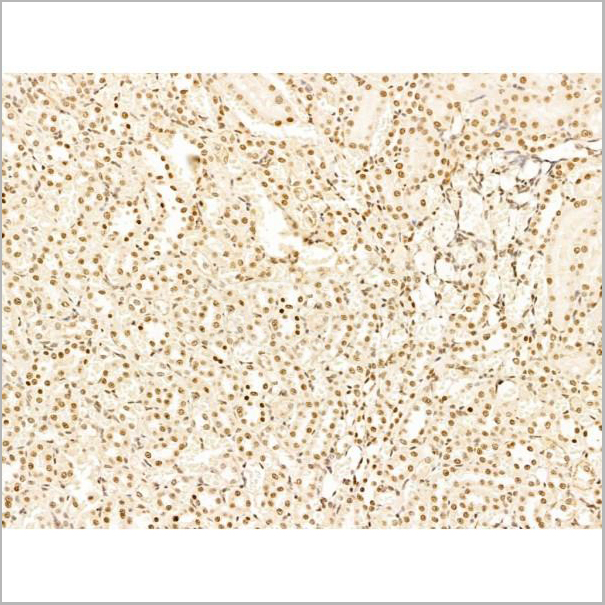 product-image-AAA31244_IHC4.jpg