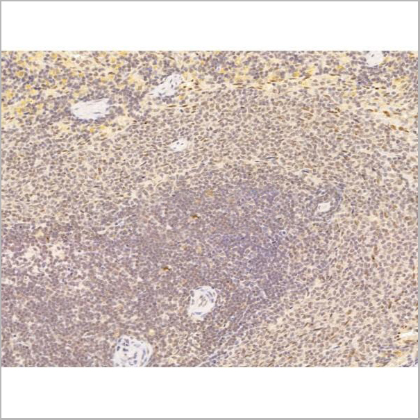product-image-AAA31244_IHC5.jpg