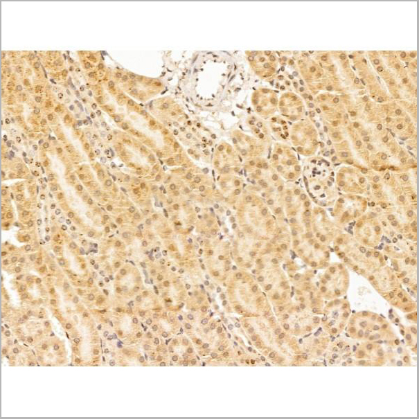 product-image-AAA31244_IHC8.jpg