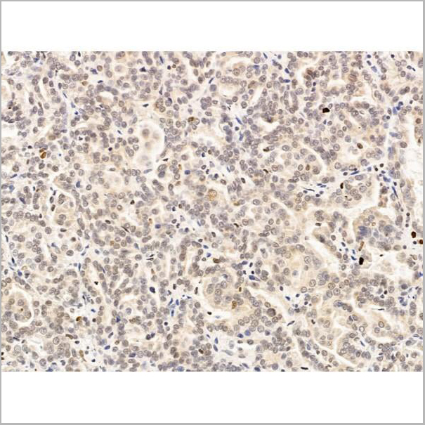 product-image-AAA31245_IHC10.jpg