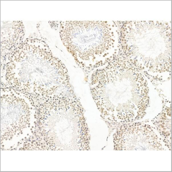 product-image-AAA31245_IHC2.jpg