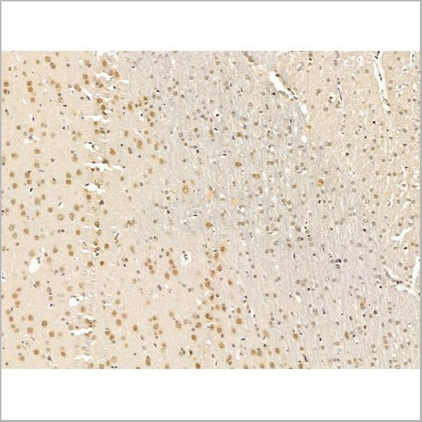 product-image-AAA31245_IHC3.jpg