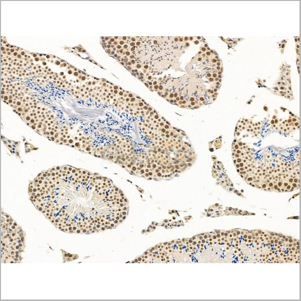 product-image-AAA31245_IHC5.jpg