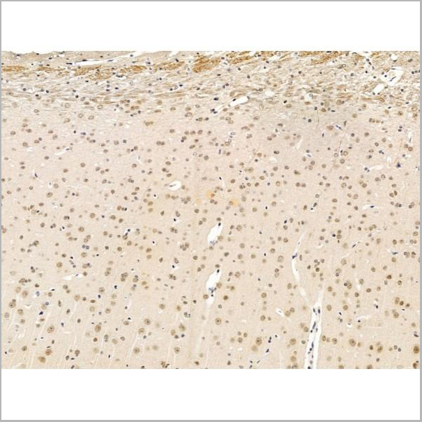 product-image-AAA31245_IHC8.jpg