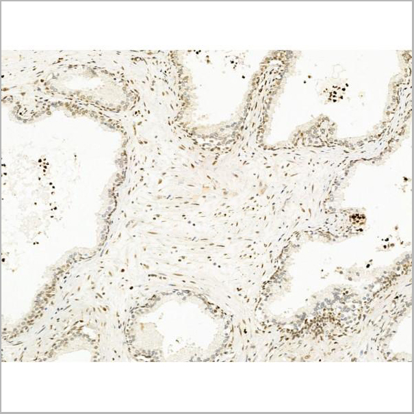 product-image-AAA31245_IHC9.jpg