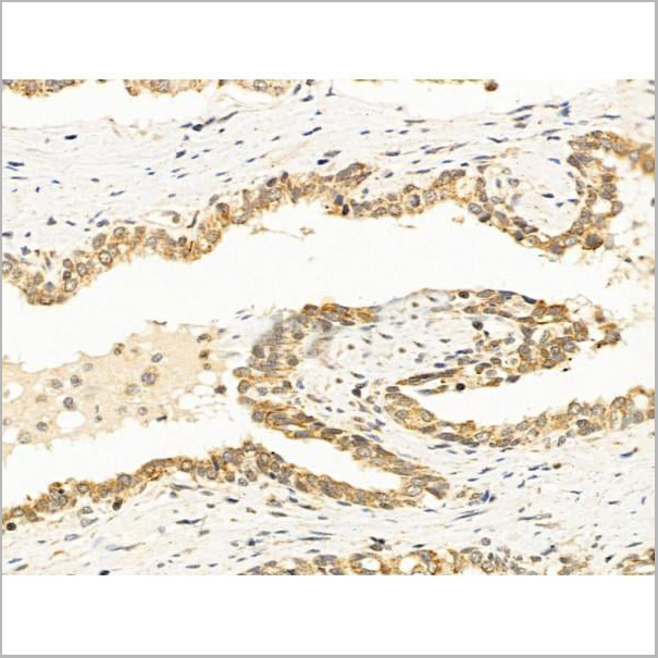 product-image-AAA31246_IHC2.jpg