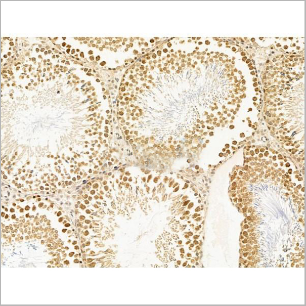 product-image-AAA31247_IHC2.jpg