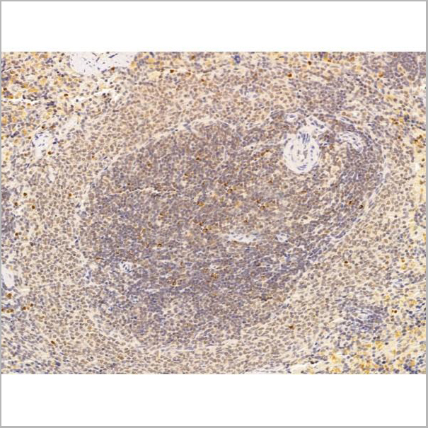 product-image-AAA31247_IHC3.jpg