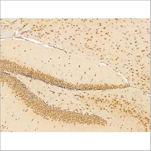product-image-AAA31247_IHC6.jpg