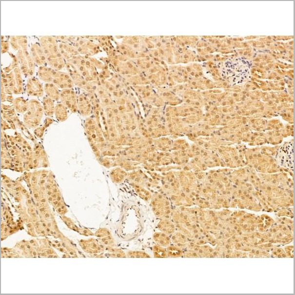 product-image-AAA31247_IHC7.jpg