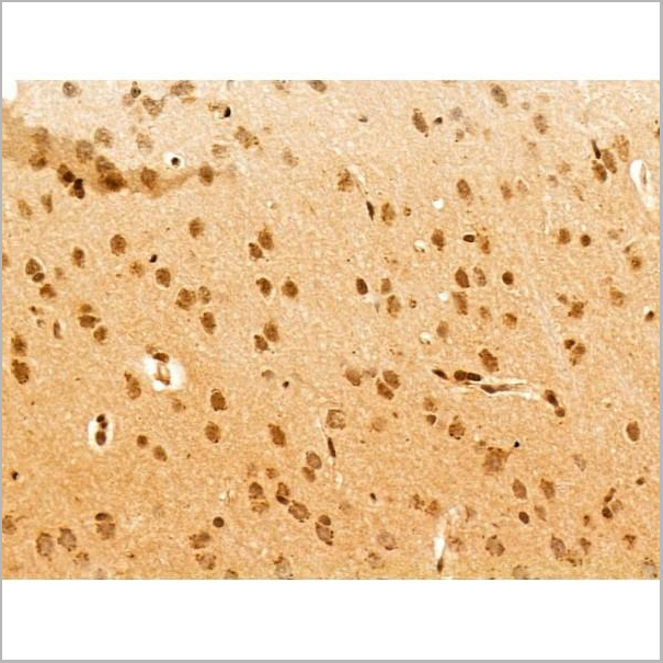 product-image-AAA31248_IHC2.jpg