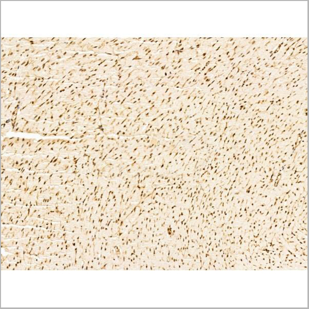 product-image-AAA31248_IHC3.jpg