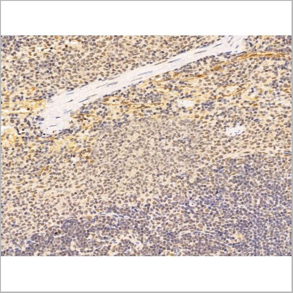 product-image-AAA31249_IHC2.jpg