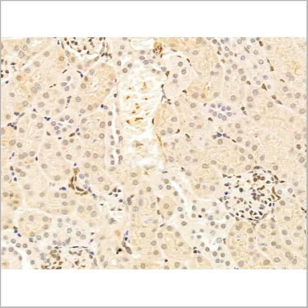product-image-AAA31250_IHC10.jpg