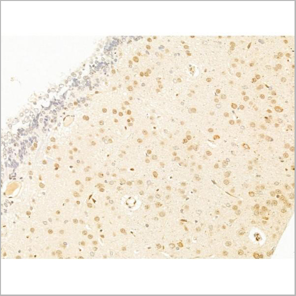 product-image-AAA31250_IHC3.jpg
