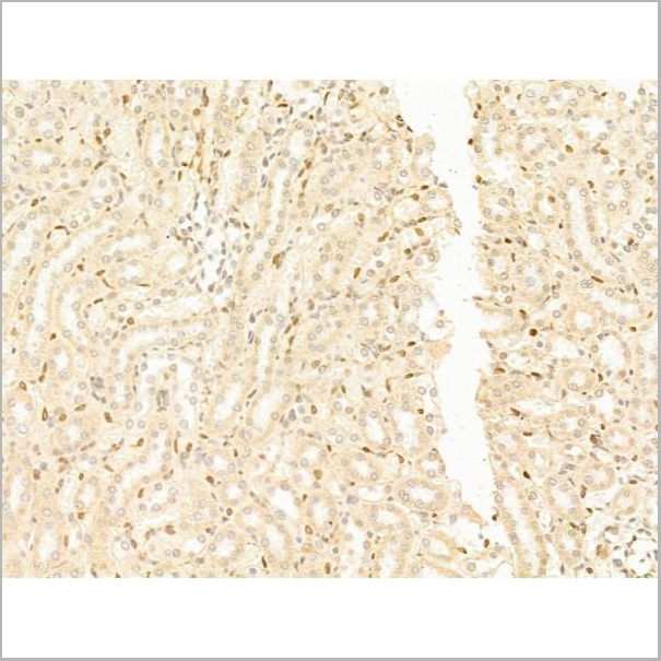 product-image-AAA31250_IHC4.jpg
