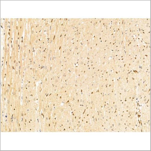 product-image-AAA31250_IHC6.jpg