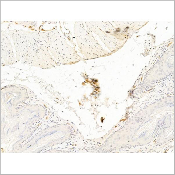 product-image-AAA31250_IHC8.jpg