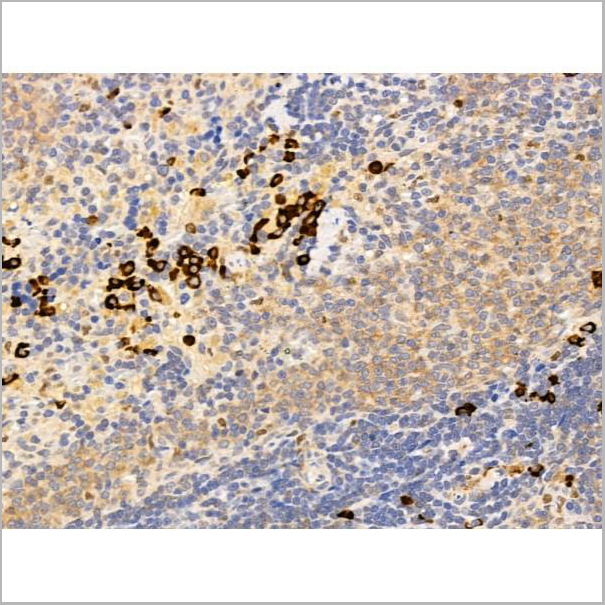 product-image-AAA31251_IHC3.jpg