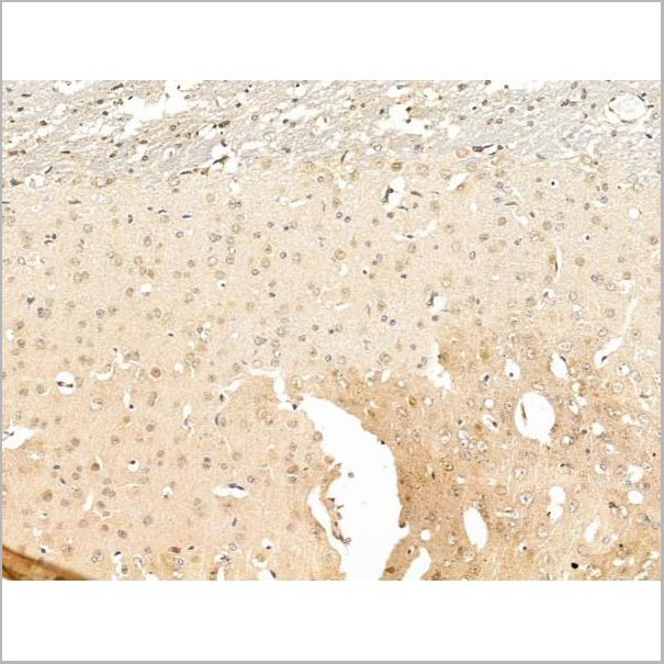 product-image-AAA31251_IHC4.jpg