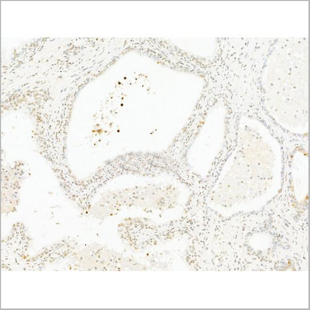 product-image-AAA31251_IHC6.jpg